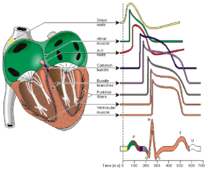 • EKG